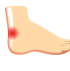 Ankle Pain