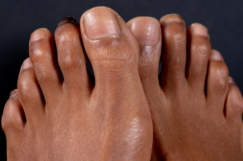 Toe Pain Podiatry Center of New Jersey